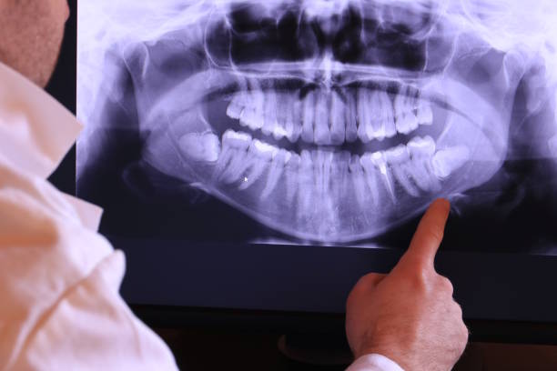 Best Dental Abscess Treatment in Lucasville, OH